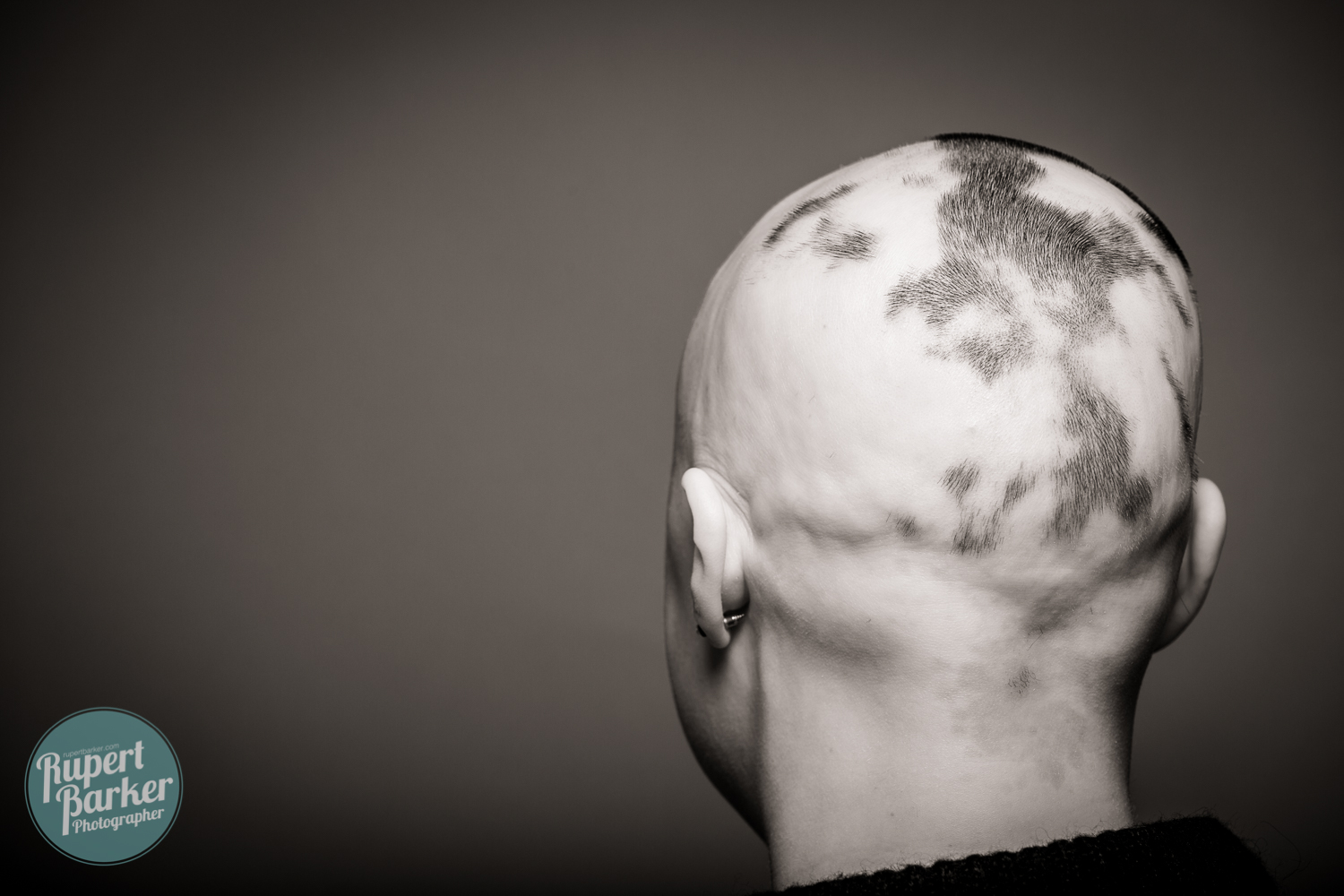 Sarah Lewis Alopecia wig bravery shaved head portrait black and white